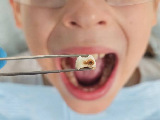 Best Emergency Dental Care for Trauma or Injury in East Greenville, PA